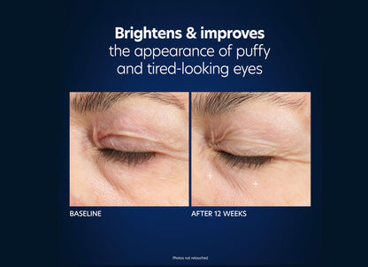 Hyaluronic Acid Microneedle Eye Patches